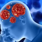 Amoebic Meningoencephalitis (AME) in Kerala: The Real Picture