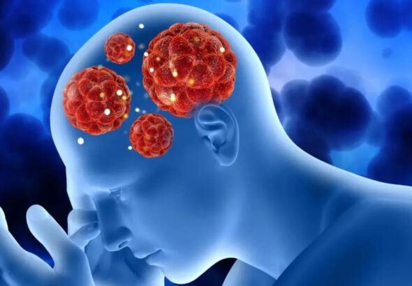 Amoebic Meningoencephalitis (AME) in Kerala: The Real Picture