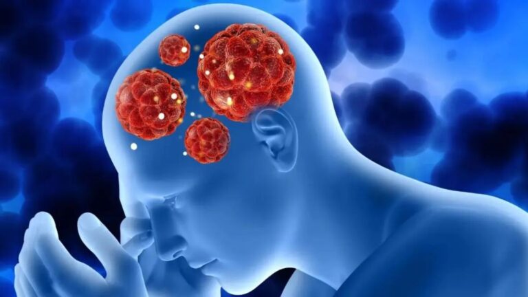 Amoebic Meningoencephalitis (AME) in Kerala: The Real Picture